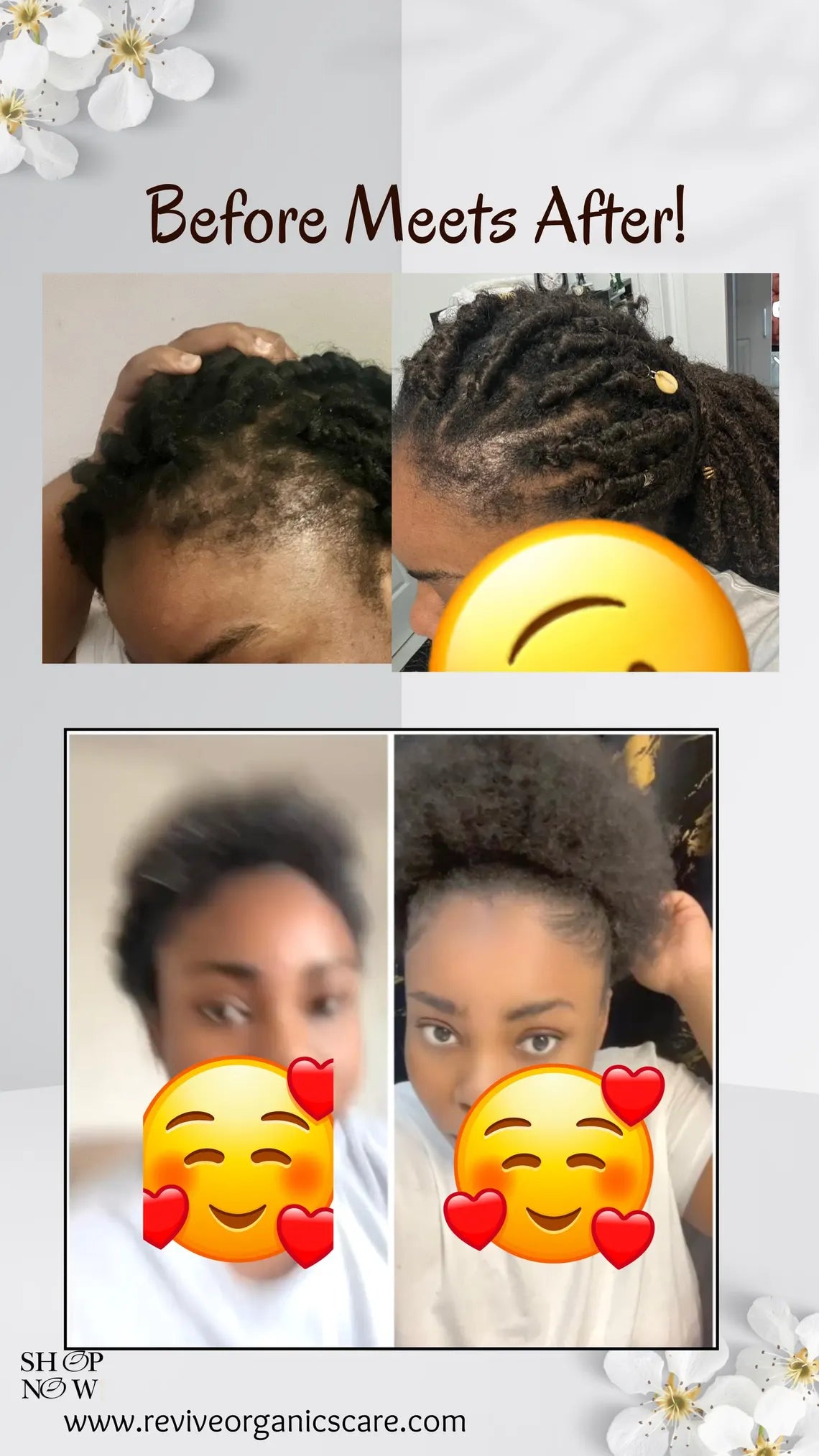 Organic Ayurvedic Hair Growth Oil (RapiGrow Hair Elixir)