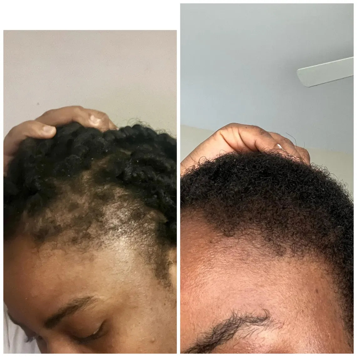 Organic Ayurvedic Hair Growth Oil (RapiGrow Hair Elixir)